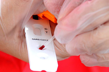 Sesi-DF vai realizar testes de Covid-19 em trabalhadores da indústria