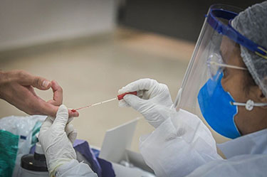 Sesi e Senai-DF apoiam a Fecomércio-DF em testes de Covid-19